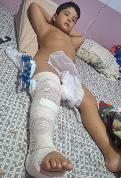 Foto 2